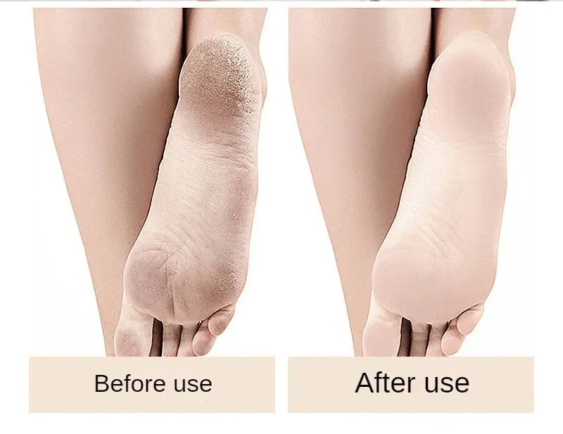 Xiaomi Konka Electric Foot Dead Skin Remover Foot Scrub Foot Exfoliator File Exfoliator Heel Smarter Grinder Portable Detachable